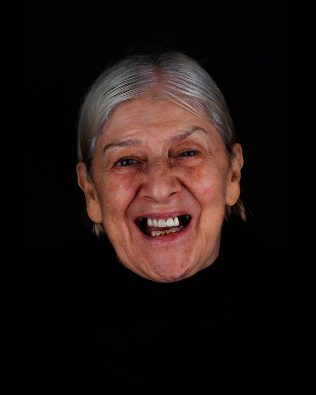 Banner odontovita implantes gravatai protocolo protese fixa protese em gravatai (29)j