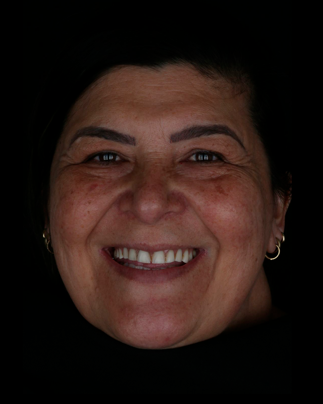 Banner odontovita implantes gravatai protocolo protese fixa protese em gravatai (31)j