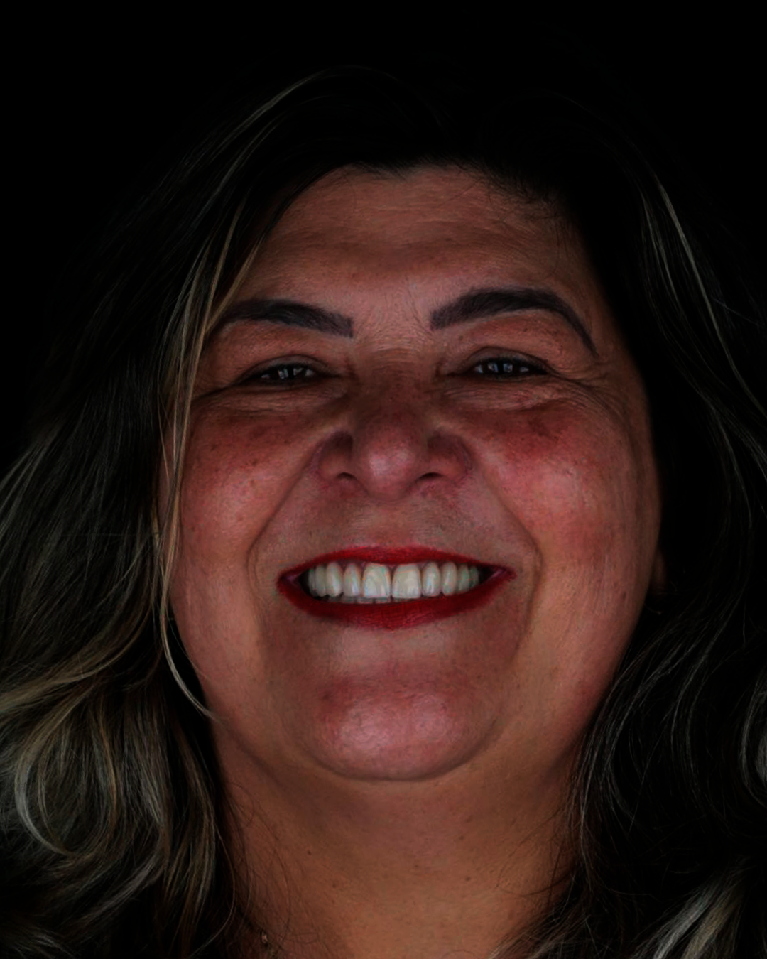 Banner odontovita implantes gravatai protocolo protese fixa protese em gravatai (32)j